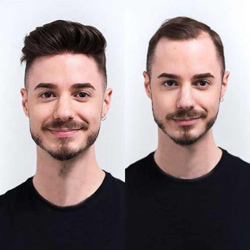 Elegant Hair swiss Lace with Super Thin Skin Hair System for Men