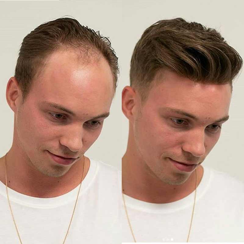 Elegant Hair Super Thin Skin Men's Hair Replacement with Lace Front